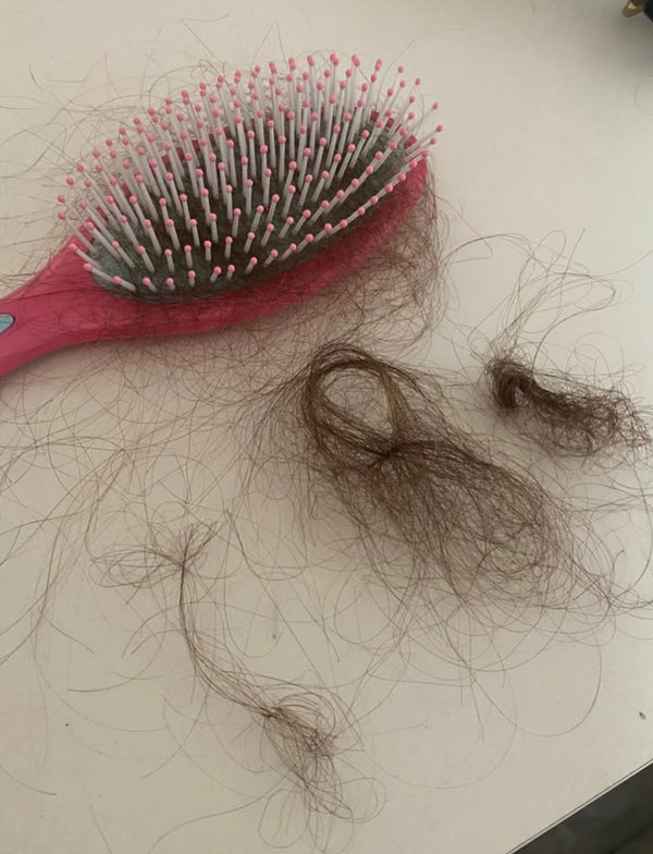 PureRise a sauvé ma chute de cheveux !